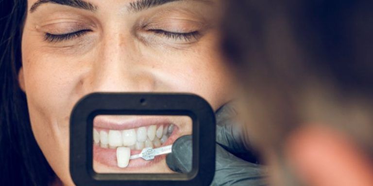 Implants or Bridges or Dentures in Waterdown